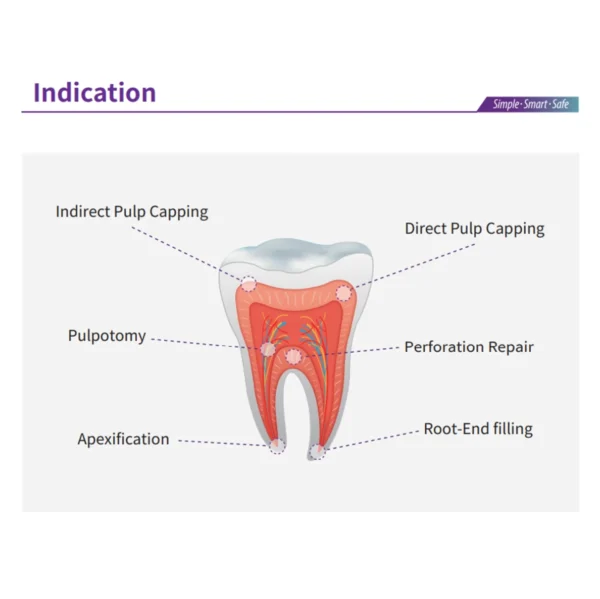 EndoCem Premixed MTA - Image 3